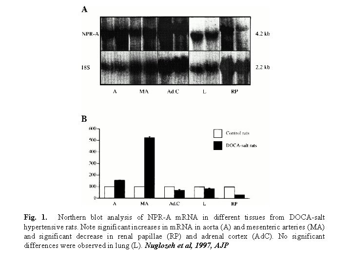 Fig. 1. Northern blot analysis of NPR-A m. RNA in different tissues from DOCA-salt