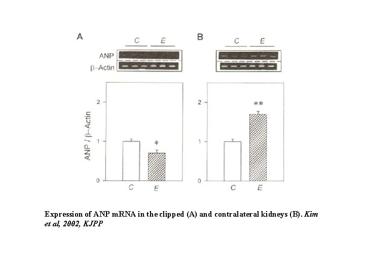Expression of ANP m. RNA in the clipped (A) and contralateral kidneys (B). Kim