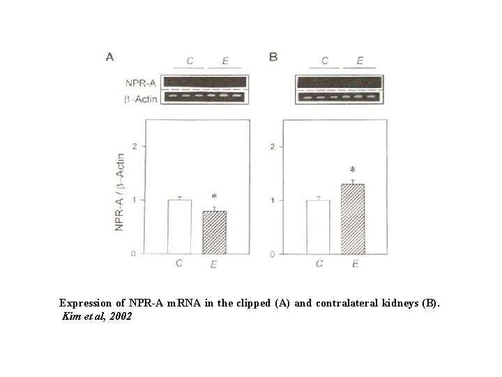 Expression of NPR-A m. RNA in the clipped (A) and contralateral kidneys (B). Kim