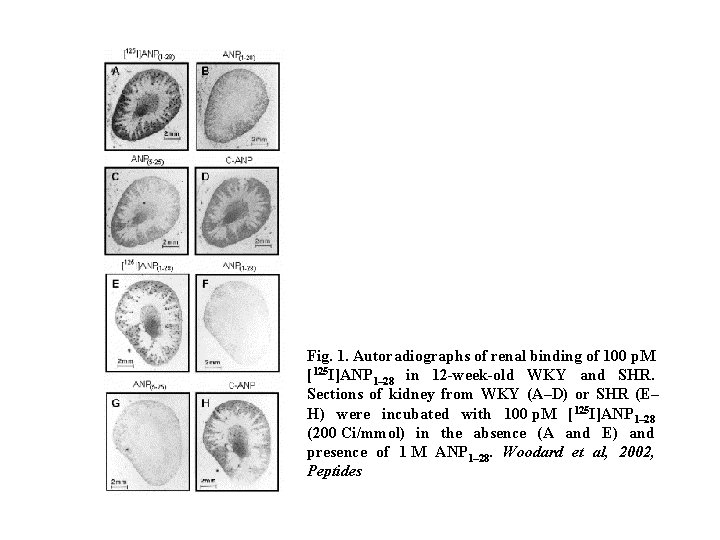 Fig. 1. Autoradiographs of renal binding of 100 p. M [125 I]ANP 1– 28