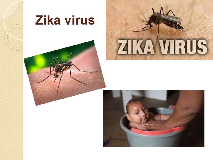 Zika virus 