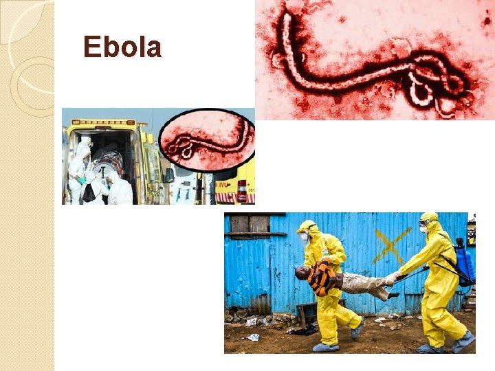Ebola 