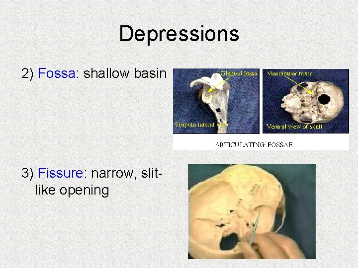 Depressions 2) Fossa: shallow basin 3) Fissure: narrow, slitlike opening 