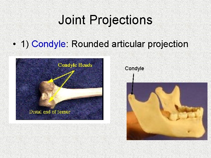 Joint Projections • 1) Condyle: Rounded articular projection Condyle 