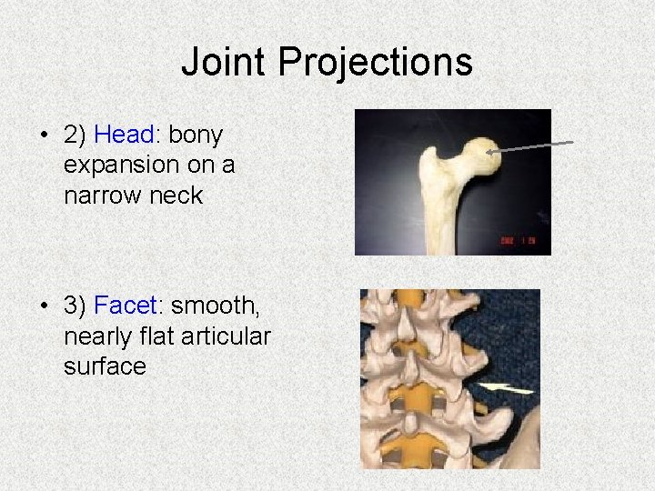 Joint Projections • 2) Head: bony expansion on a narrow neck • 3) Facet: