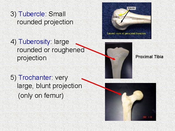 3) Tubercle: Small rounded projection 4) Tuberosity: large rounded or roughened projection 5) Trochanter: