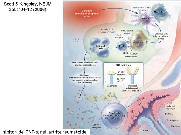 Scott & Kingsley, NEJM 355: 704 -12 (2006) Inibitori del TNF-a nell’artrite reumatoide 