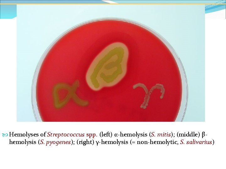  Hemolyses of Streptococcus spp. (left) α-hemolysis (S. mitis); (middle) βhemolysis (S. pyogenes); (right)