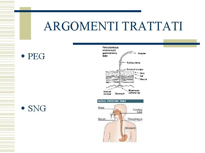 ARGOMENTI TRATTATI w PEG w SNG 