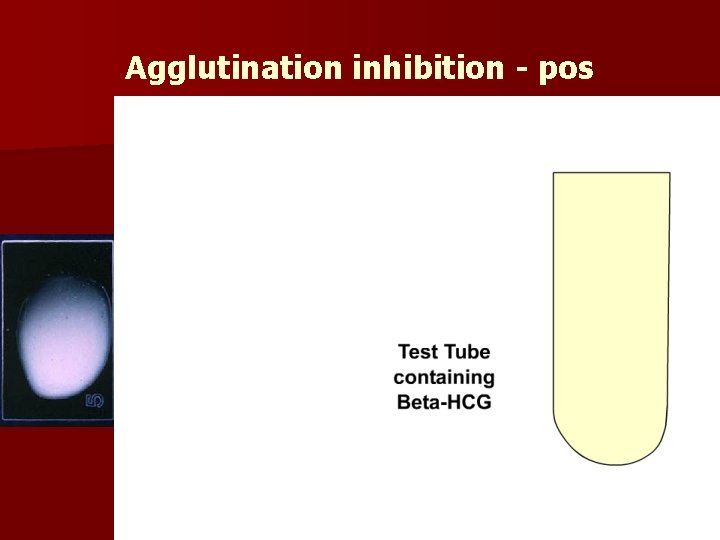 Agglutination inhibition - pos 