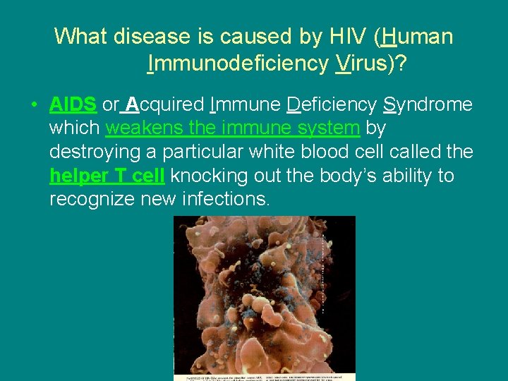 What disease is caused by HIV (Human Immunodeficiency Virus)? • AIDS or Acquired Immune
