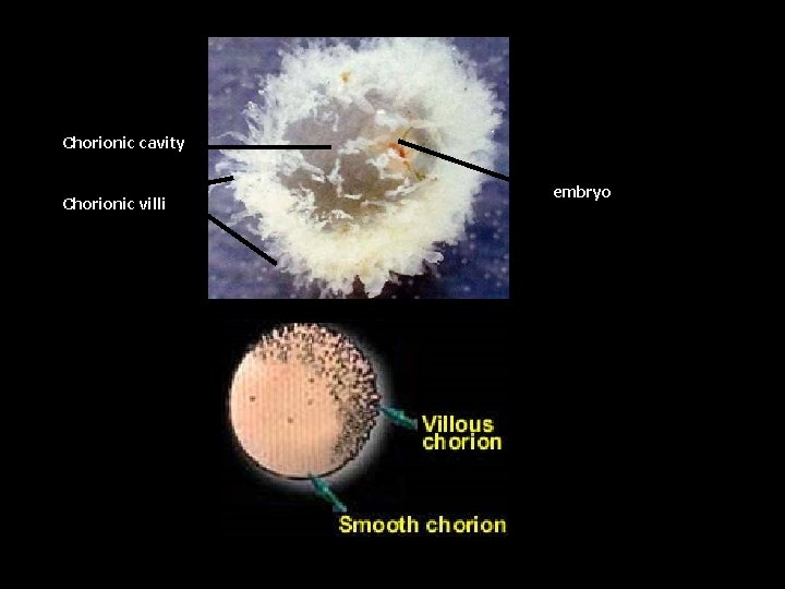 Chorionic cavity Chorionic villi embryo 