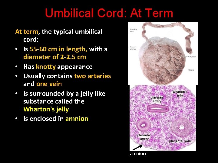 Umbilical Cord: At Term At term, the typical umbilical cord: • Is 55 -60