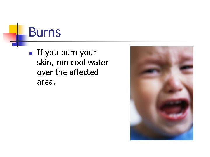 Burns n If you burn your skin, run cool water over the affected area.