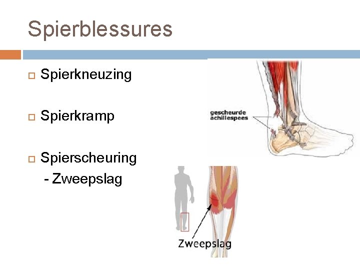 Spierblessures Spierkneuzing Spierkramp Spierscheuring - Zweepslag 