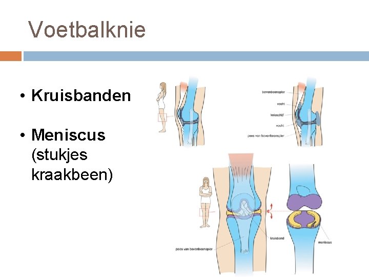 Voetbalknie • Kruisbanden • Meniscus (stukjes kraakbeen) 