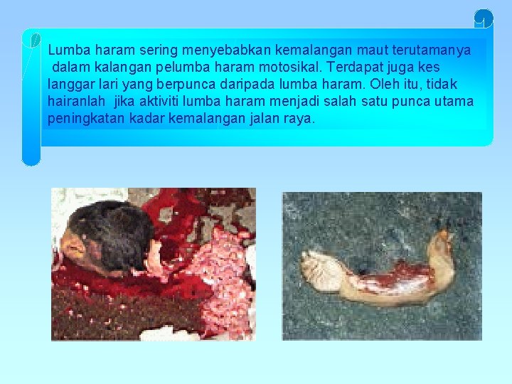 Lumba haram sering menyebabkan kemalangan maut terutamanya dalam kalangan pelumba haram motosikal. Terdapat juga