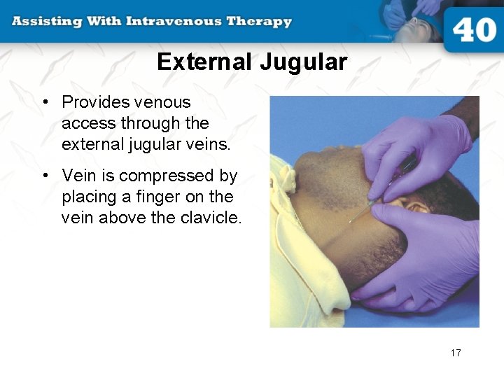 External Jugular • Provides venous access through the external jugular veins. • Vein is