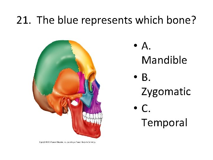 21. The blue represents which bone? • A. Mandible • B. Zygomatic • C.