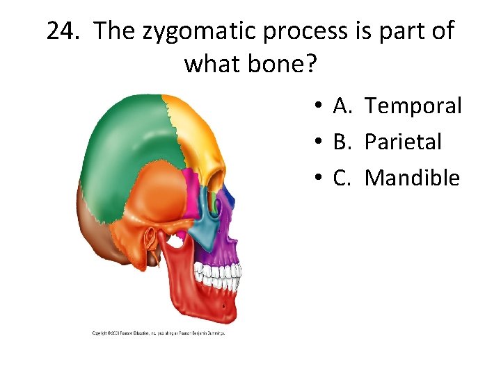 24. The zygomatic process is part of what bone? • A. Temporal • B.
