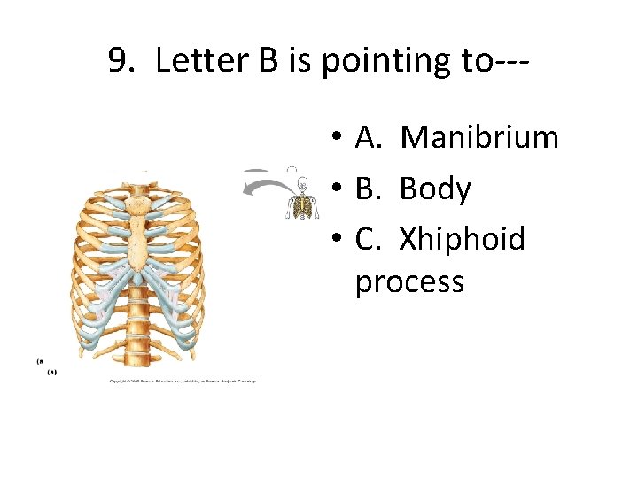 9. Letter B is pointing to-- • A. Manibrium • B. Body • C.