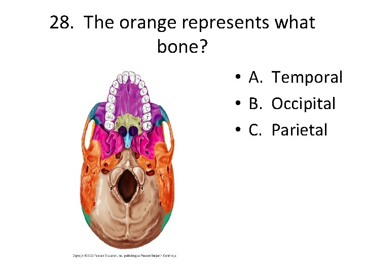 28. The orange represents what bone? • A. Temporal • B. Occipital • C.