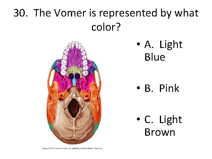 30. The Vomer is represented by what color? • A. Light Blue • B.