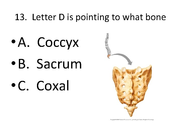13. Letter D is pointing to what bone • A. Coccyx • B. Sacrum