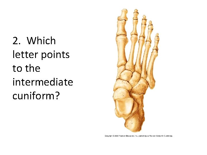 2. Which letter points to the intermediate cuniform? 