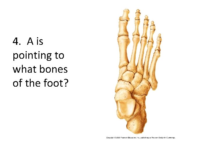 4. A is pointing to what bones of the foot? 