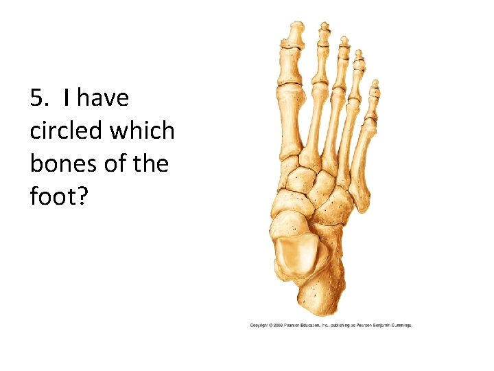 5. I have circled which bones of the foot? 