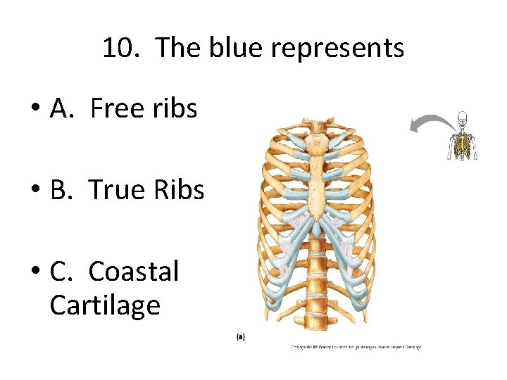 10. The blue represents • A. Free ribs • B. True Ribs • C.