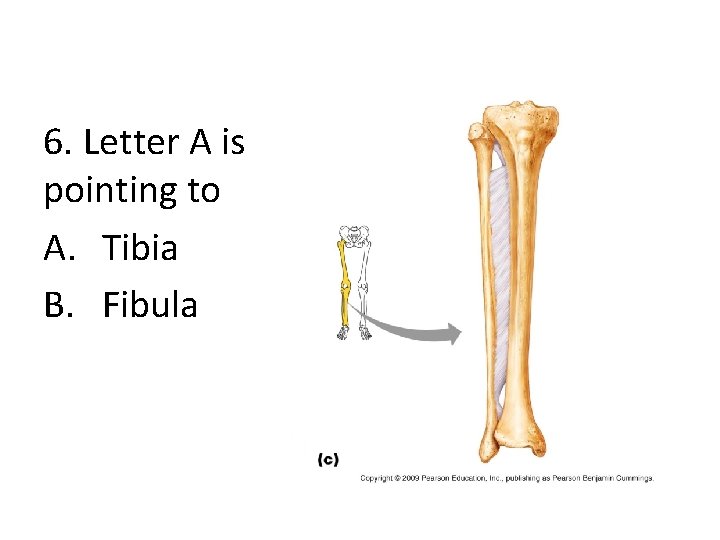 6. Letter A is pointing to A. Tibia B. Fibula 