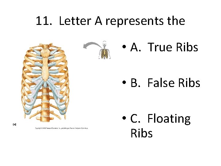 11. Letter A represents the • A. True Ribs • B. False Ribs •