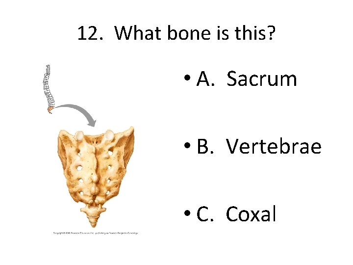 12. What bone is this? • A. Sacrum • B. Vertebrae • C. Coxal