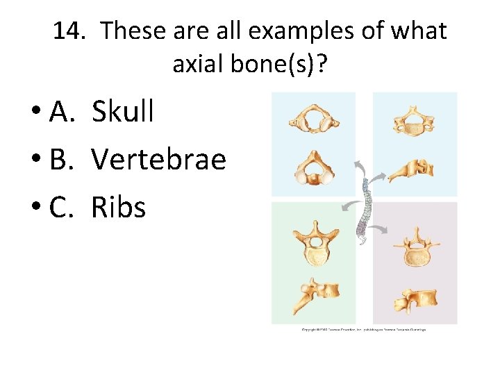 14. These are all examples of what axial bone(s)? • A. Skull • B.