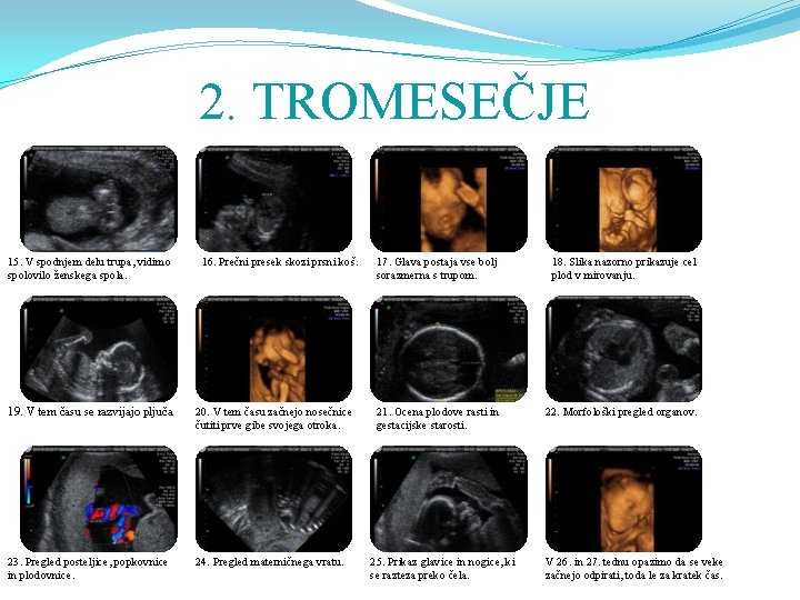 2. TROMESEČJE 15. V spodnjem delu trupa, vidimo spolovilo ženskega spola. 16. Prečni presek