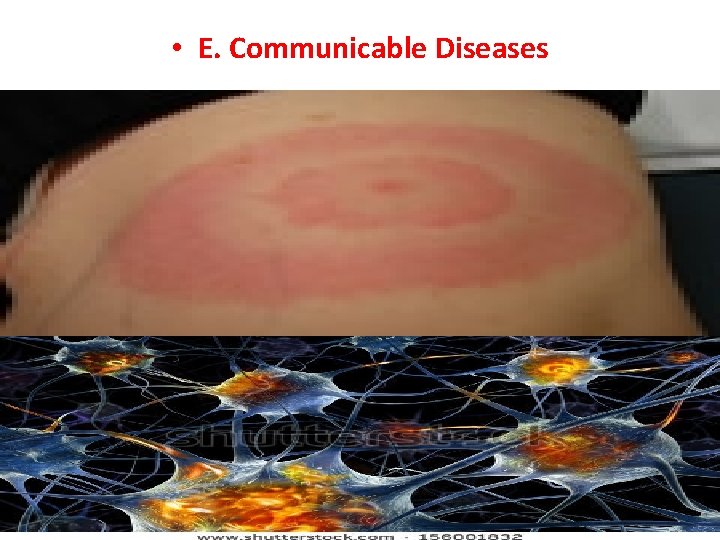  • E. Communicable Diseases 