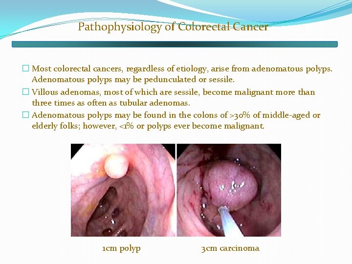 Pathophysiology of Colorectal Cancer � Most colorectal cancers, regardless of etiology, arise from adenomatous