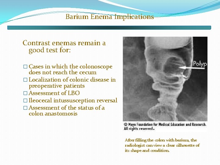 Barium Enema Implications Contrast enemas remain a good test for: � Cases in which