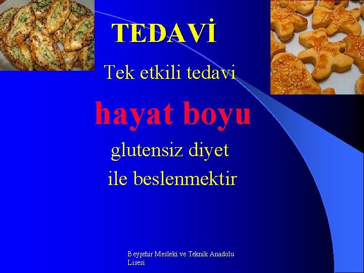 TEDAVİ Tek etkili tedavi hayat boyu glutensiz diyet ile beslenmektir Beyşehir Mesleki ve Teknik