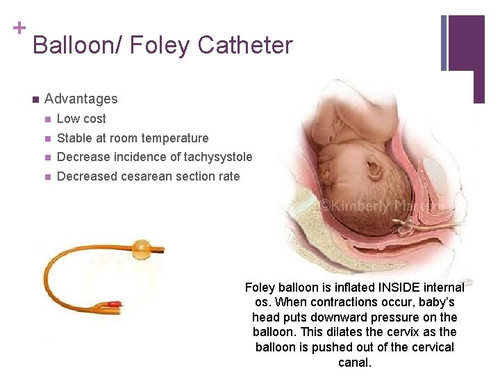 + Balloon/ Foley Catheter n Advantages n Low cost n Stable at room temperature