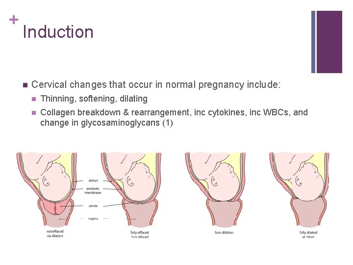 + Induction n Cervical changes that occur in normal pregnancy include: n Thinning, softening,