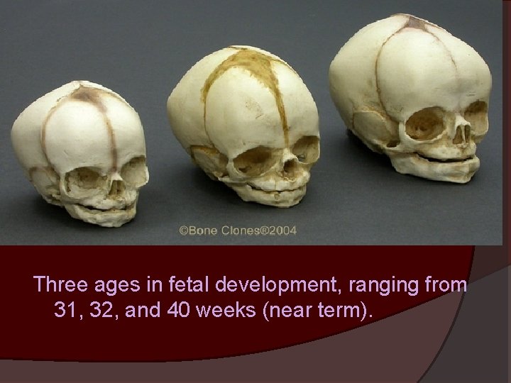 Three ages in fetal development, ranging from 31, 32, and 40 weeks (near term).