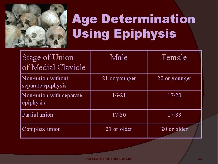 Age Determination Using Epiphysis Stage of Union of Medial Clavicle Male Female 21 or