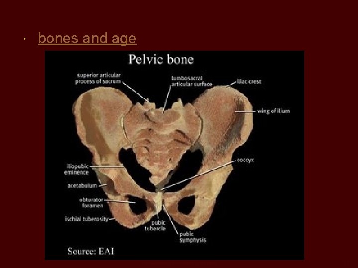  bones and age Kendall/Hunt Publishing Company 25 