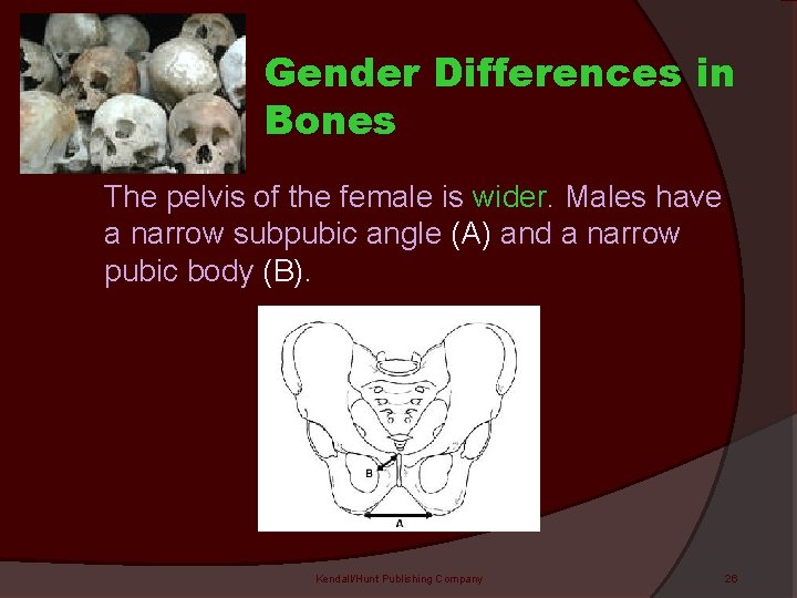 Gender Differences in Bones The pelvis of the female is wider. Males have a