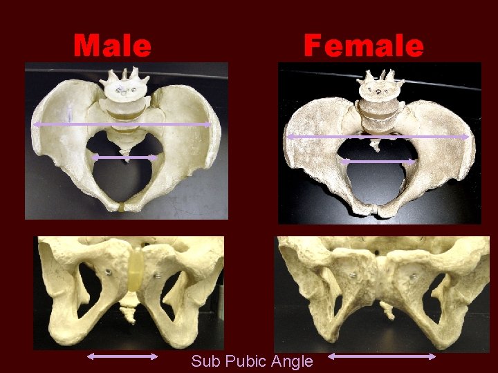 Male Female Sub Pubic Angle 