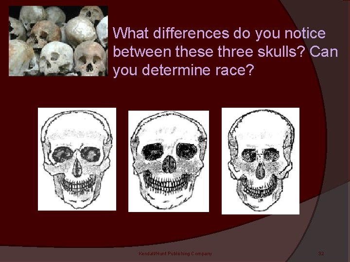 What differences do you notice between these three skulls? Can you determine race? Kendall/Hunt