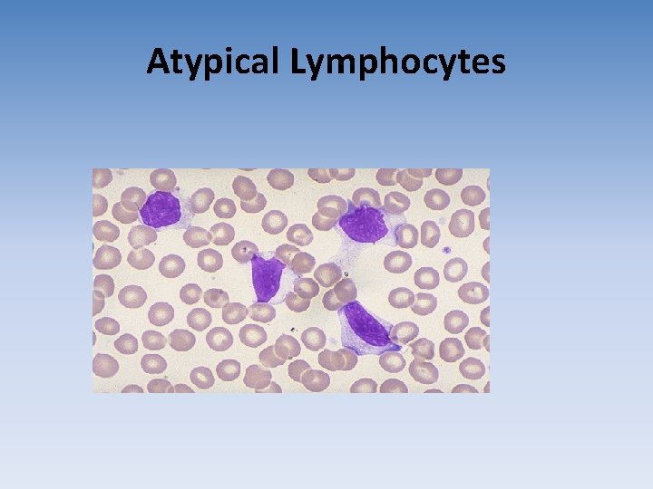 Atypical Lymphocytes Atypical Lymphocytes